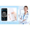 New Wireless Smart Phone Wifi Iphone Ultrasound Probe